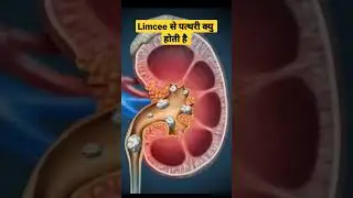 Limcee Tablet Side Effects in Hindi #limcee #shorts #limceetablet