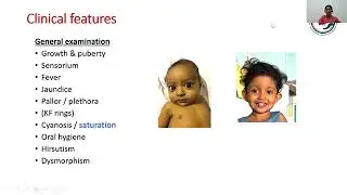 Management Of A Child With Chronic Liver Disease