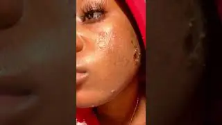 Effect of ZENA Algae peeling