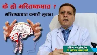 के हो मस्तिष्कघात ? मस्तिष्कघात कसरी हुन्छ ? उपचार के हो ?