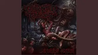 Human Fetus Parasite