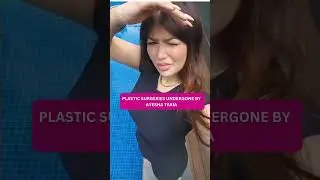 Did Ayesha Takia Get Plastic Surgery? | Facial Changes Explained | Awareness Video