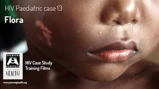 HIV Paediatric Case Study Training Films &bull; 13. Flora