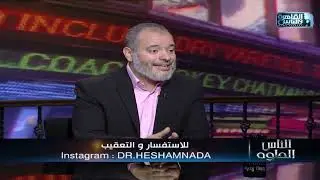 الناس الحلوة | اسباب الهالات السوداء وأنواعها وطرق التخلص منها مع دكتور هشام ندا