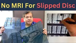 Low Back Pain treatment, MRI For Disc Bulge, Lumbar Spine MRI, Symptoms of Herniated Disc