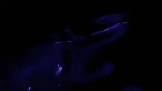 Samsung smart custom contact lens image projector illegally implanted in my eyes