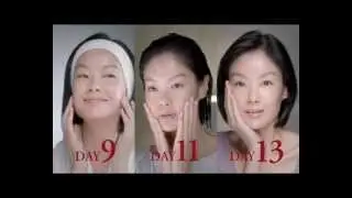 Sheila Sim and her 14-day skin transformation with SK-II