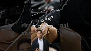 Essas veias saltadas s&atilde;o varizes? 🤔
