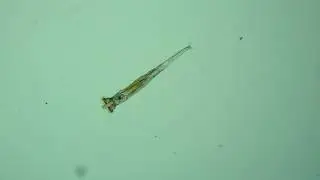 Бделлоидная коловратка - Rotifera Bdelloidea