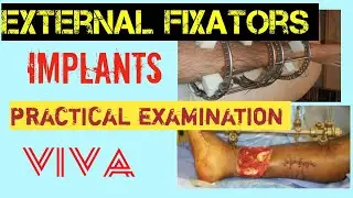 Orthopaedic #implants/ external fixators/#clinical #examination #ortho#ilizarov