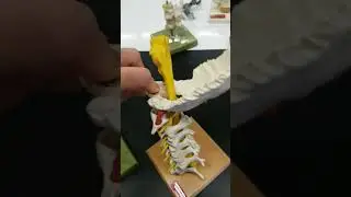 Specific vertebrae - Atlas, Axis, Vertebra prominens