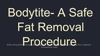 Bodytite  A Safe Fat Removal Procedure