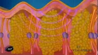 Venus Freeze&trade; Non Surgical Body Contouring and Skin Tightening