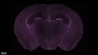 Mouse brain cleared with CUBIC