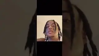 #boonk speaks on the hardest part of having his jaw wired for 6 weeks.