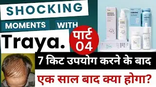 Part-4🎯 Traya hair kit review after 7 kits used |  Traya hair loss solution, review will continue 1y