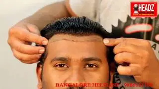 Hair fixing in Coimbatore | Hair Patch in Coimbatore | Wigs in Coimbatore. Call 63606 26600
