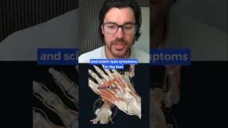 What happens in Morton's neuroma