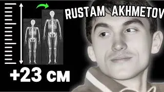 He Grew 21 centimetres At the Age of 21 | RUSTAM AKHMETOV Height Increase Routine Explained