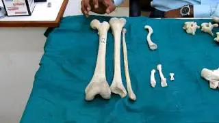 Classification of Bone According To Their Shape