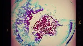 BODY & MIND PURIFICATION | SCALAR ENERGY FIELD