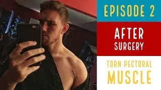 After Surgery - Torn Pectoral Muscle - Episode 2
