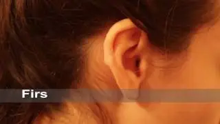 Earlobe Keloid Treatment with Cryotherapy - Interim Results