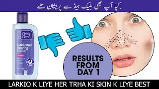 clean & clear blackheads clearing cleanser #cleanandclear #bestcleanser #blackheads #besttoner