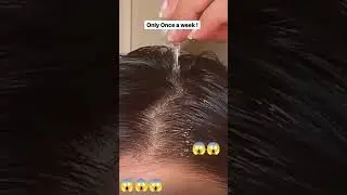How to use  vitamin E capsule for coconut oil !! Hair Growth! Hair fall l rough  & frizzy hair