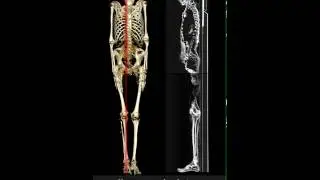 Mummy CT Scan animation