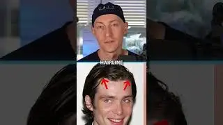 Лицо Киллиана Мёрфи полностью натуральное? | Анализ пластической хирургии