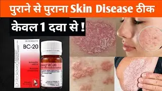 सब Skin Disease का एक ही इलाज | Best Homeopathic Medicine for All Skin Problems