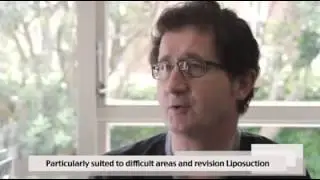 Julian Lofts Liposuction Procedure Profile