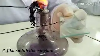 Bakteri Staphylococcus aureus 720p