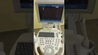 Medison Sonoace X6