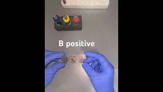 B positive blood group #youtubeshorts #shorts #learning #satisfying