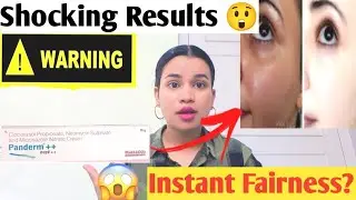 Panderm++ Cream Uses & Side Effects] Panderm cream review Crystal glow|| skin whitening Review 2022