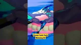 Cleaner Smile Teeth Whitening Kit😁||#shorts