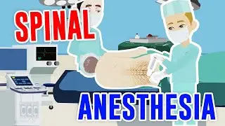 SPINAL ANESTHESIA: Indications, Procedures, and Advantages