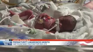 Premature baby fighting for her life, born weighing only 1 pound