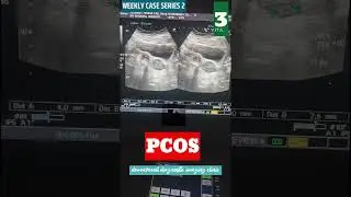 WEEKLY CASE SERIES 2: Dr Muzamil diagnostic imaging. #fy #ultrasound #ultrasoundguided #ultrasound