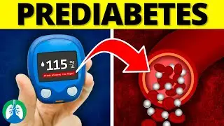Преддиабет (медицинское определение) | Краткое пояснительное видео