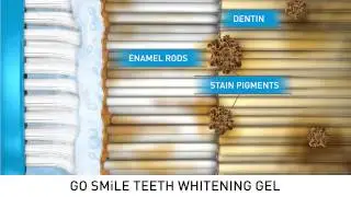 Teeth Whitening Gel - How it works