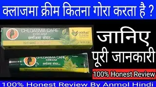 Chloasma Care Cream Full Review By Anmol Hindi