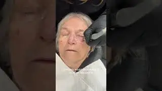 Patient Testimonial