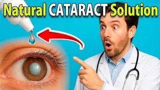 Natural Cataract Solution | How to Improve Cloudy Vision Without Surgery