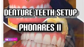 Dentures TEETH  Setup Phonares 2