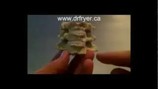 Neck Cracking Spine Model - Dr. Jerome Fryer (Chiropractor)