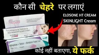 Skinlight Cream vs Elosone Ht Cream - कौन सी ज्यादा असरकारक है, सस्ती भी और अच्छी भी | जरूर देखें 