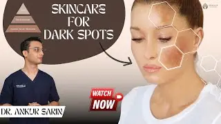 Remove Dark spots With Dermatologists Proven Method | ￼Home Treatments | Hyperpigmentation Cure |